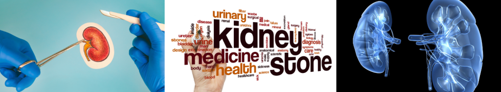 University of Dundee Performs Research on Kidney Failure Patients